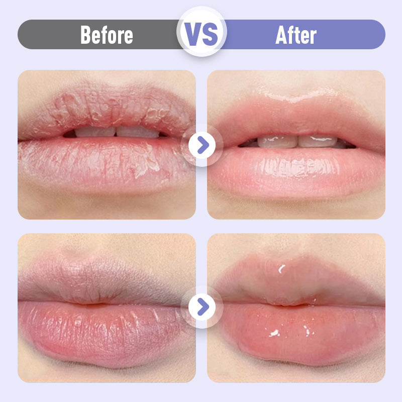 👑Fugtgivende læbeserum, der giver fylde og bekæmper rynker💋